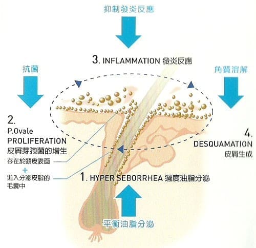 頭皮屑的治療

1. 避免內、外在刺激因子與誘發皮屑問題等因素
2. 使用輔助皮膚醫學治療的洗髮類產品，將更有效延長治療效果與降低復發率
3. 如果頭皮問題持續發作，請盡早求診於皮膚科醫師
