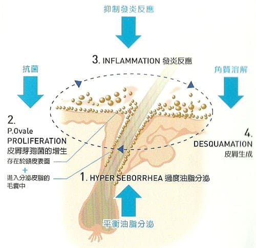 頭皮屑的治療
1. 避免內、外在刺激因子與誘發皮屑問題等因素
2. 使用輔助皮膚醫學治療的洗髮類產品,將更有效延長治療效果與降低復發率
3. 如果頭皮問題持續發作,請盡早求診於皮膚科醫師