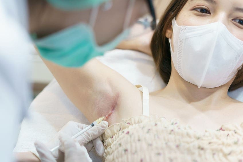 肉毒腋下止汗除臭(多汗症)