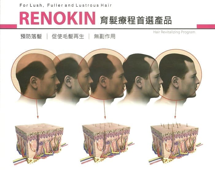 RENOKIN育髮療程