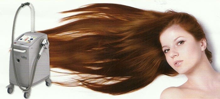 3D飛梭生髮雷射