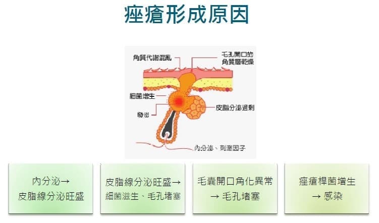 我會長青春痘的原因