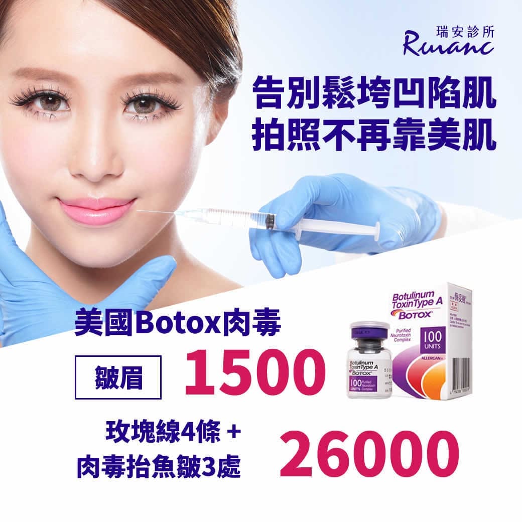 肉毒桿菌BOTOX