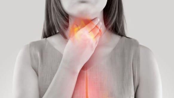 Gastroesophageal Reflux Disease
