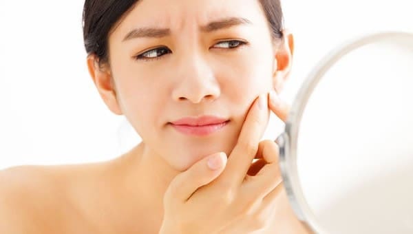 Troubled by Acne?