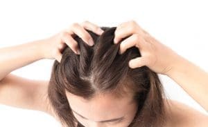 Female Hair Loss
